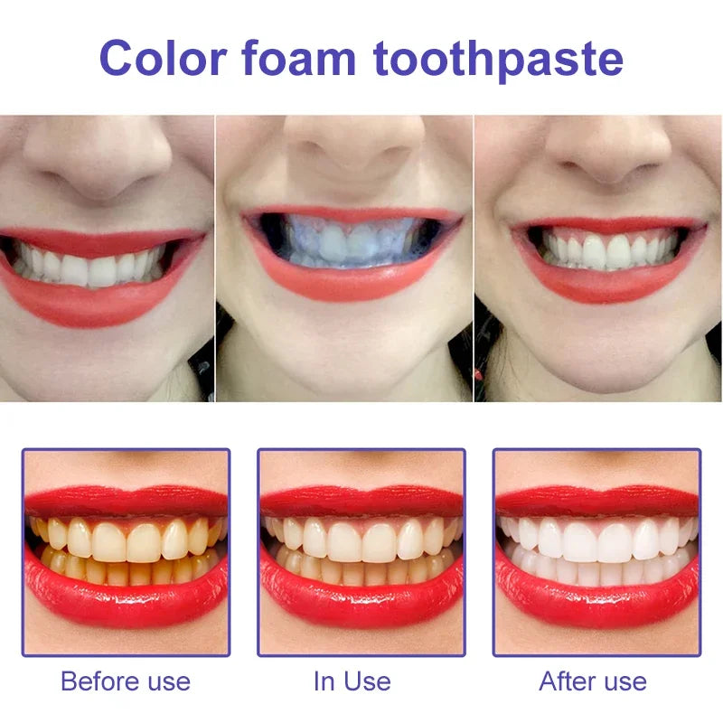 Whitening repairing toothpaste